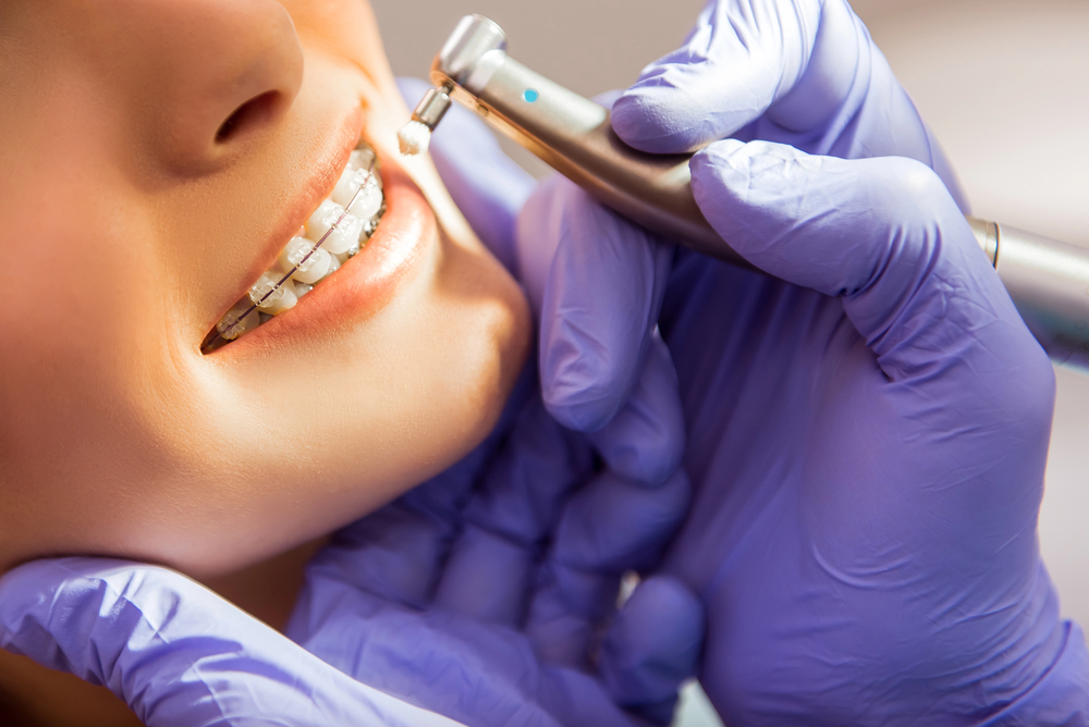 Orthodontic Treatment