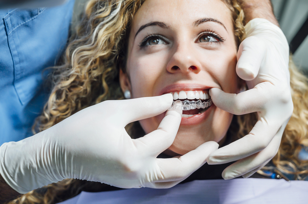 How Invisalign Works: The Technology Behind the Smile